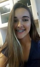 First day with my braces on! It hurts A LOT, but I'm thinking of the end result, and I can't wait!!